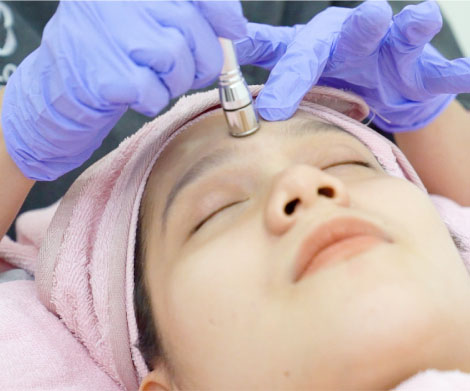 Microdiamond Dermabration